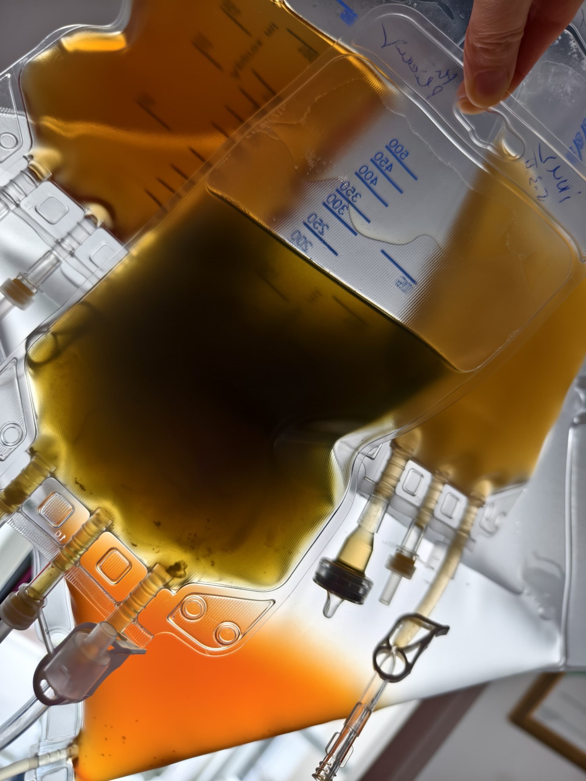 VÉRTISZTÍTÁS_HEMOPURE